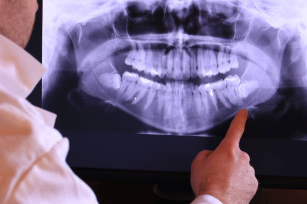 Best Emergency Treatment for Jaw Pain or Injury in Spring Creek, NV
